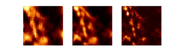 Próbka biologiczna: mikrotubule znakowane kropkami kwantowymi; od lewej obraz uzyskany: w standardowym mikroskopie, metodą ISM, metodą Q-ISM. Ilustracja wykonana na podstawie danych przedstawionych w suplemencie do publikacji “Super-resolution enhancement by quantum image scanning microscopy” w ,,Nature Photonics’’. (Źródło: Alexander Krupiński-Ptaszek, Wydział Fizyki UW)