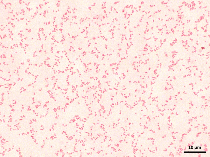 Barwienie Grama wyizolowanej z osadu czynnego bakterii BB2 obserwowanej w mikroskopie świetlnym (powiększenie x100). Arch. Anny Dzionek