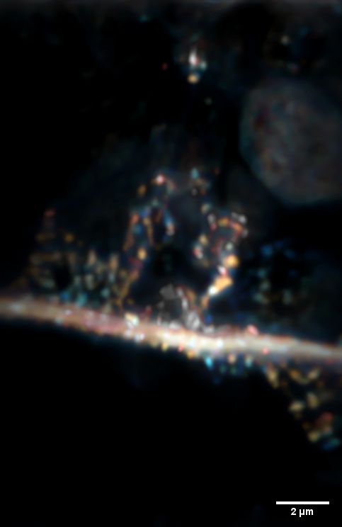 Neuryt wraz z dołączonymi do niego synapsami (okrągłe elementy dołączone do „gałęzi”). Próbka obrazowana mikroskopem optycznym znajduje się na głębokości  80 mikrometrów – pod powierzchnią innych komórek. Źródło:  dr Piotr Zdańkowski, ACS Nano https://doi.org/10.1021/acsnano.9b05891      