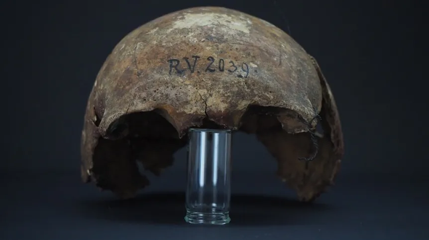 Fragment czaszki człowieka, pochowanego w Rinnukalns (Łotwa) ok 5 tys. lat temu. Fot. Dominik Göldner, BGAEU, Berlin