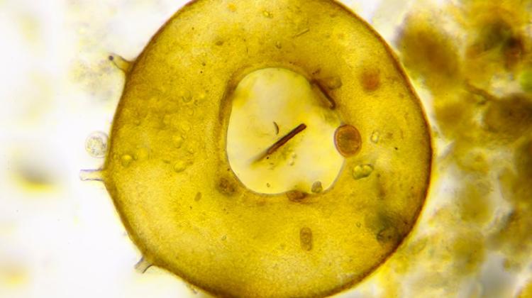 mikroskopowy obraz skorupki ameby Centropyxis aculeata, fot. Adobe Stock