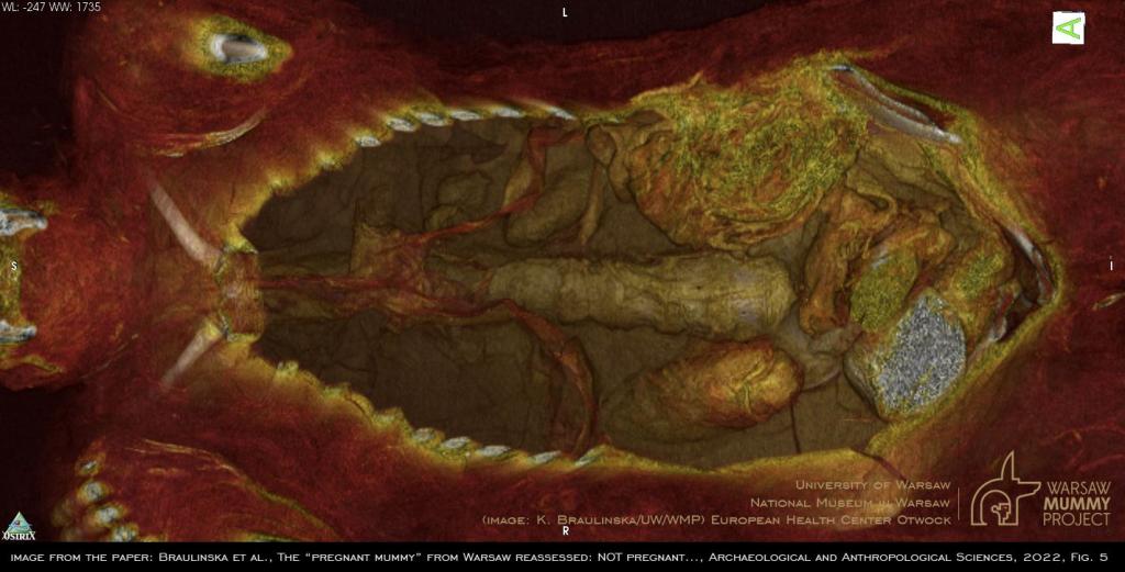 3D color reconstruction of a cross-section through the mummy, using OsiriX MD (Pixmeo) software. Frontal view into the mummy filled with packages of different nature. The packages are partly immersed in resin, thus fixed in the different cavities of the mummy. K.Braulińska (UW/WMP)