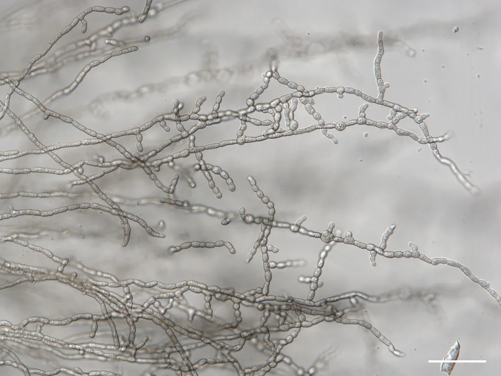 Formicomyces microglobosus ined. Bar = 50 um 1. Fot.  M.Piątek & I. Siedlecki
