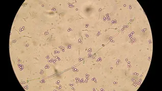 Mikroskopowy obraz candida albicans, fot. Adobe Stock
