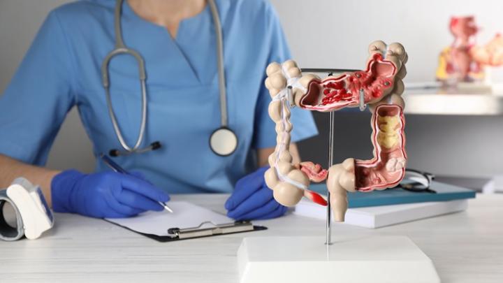 Niedobór białka p53 przyczyną raka jelita grubego