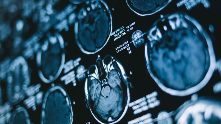 FNP: ponad 68 mln zł na badania nad chorobami mózgu i czujnikami nowej generacji