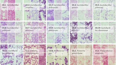 Być może kiedyś zdjęcie z mikroskopu optycznego wystarczy, aby sztuczna inteligencja rozpoznała gatunek bakterii. Na zdjęciu bakterie analizowane w badaniach naukowców z UJ i PK. Każdy gatunek zilustrowany jest trzema przykładami. Źródło: PLOS One, Bartosz Zieliński et al.