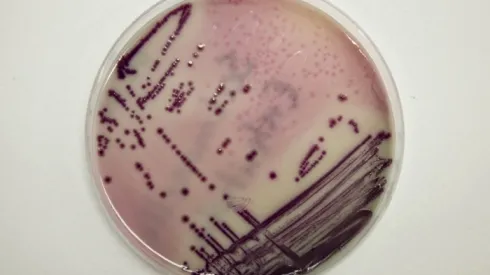 Bakteria Salmonella enteritidis wyhodowana w szalce laboratorium Wojewódzkiej Stacji Sanitarno-Epidemiologicznej w Gorzowie Wielkopolskim (lm/pkus) PAP/Lech Muszyński