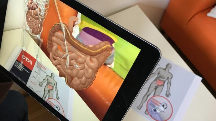 Test simulation in Augmented Reality - the capsule travelling inside the intestine. Source: CTAdventure
