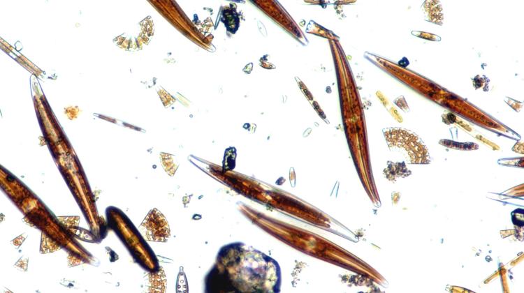 Zbiorowisko „żywych” okrzemek – obserwacja w mikroskopie świetlnym. Fot. Uniwersytet Łódzki
