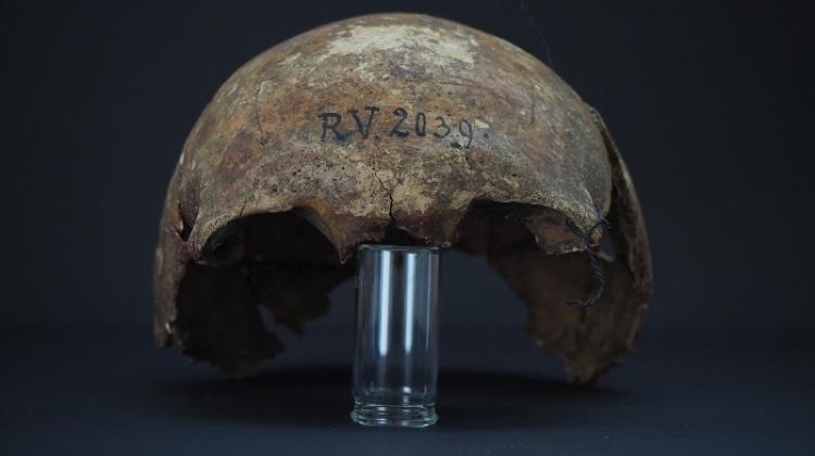 Fragment czaszki człowieka, pochowanego w Rinnukalns (Łotwa) ok 5 tys. lat temu. Fot. Dominik Göldner, BGAEU, Berlin