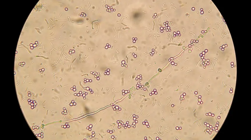 Mikroskopowy obraz Candida albicans, fot. Adobe Stock