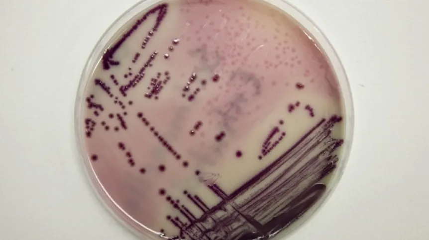 Bakteria Salmonella enteritidis wyhodowana w szalce laboratorium Wojewódzkiej Stacji Sanitarno-Epidemiologicznej w Gorzowie Wielkopolskim (lm/pkus) PAP/Lech Muszyński