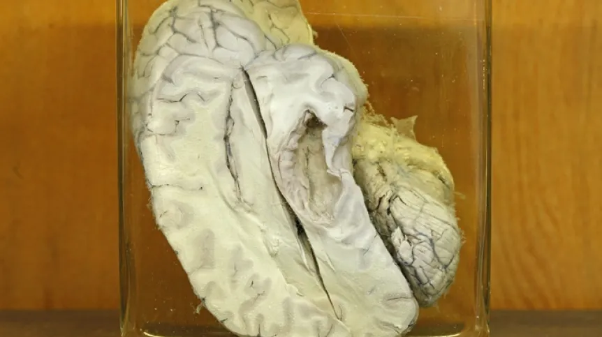 Mózg w pracowni anatomii Uniwersytetu Medycznego w Białymstoku, Muzeum Historii Medycyny i Farmacji, PAP/Artur Reszko (ar/awol)