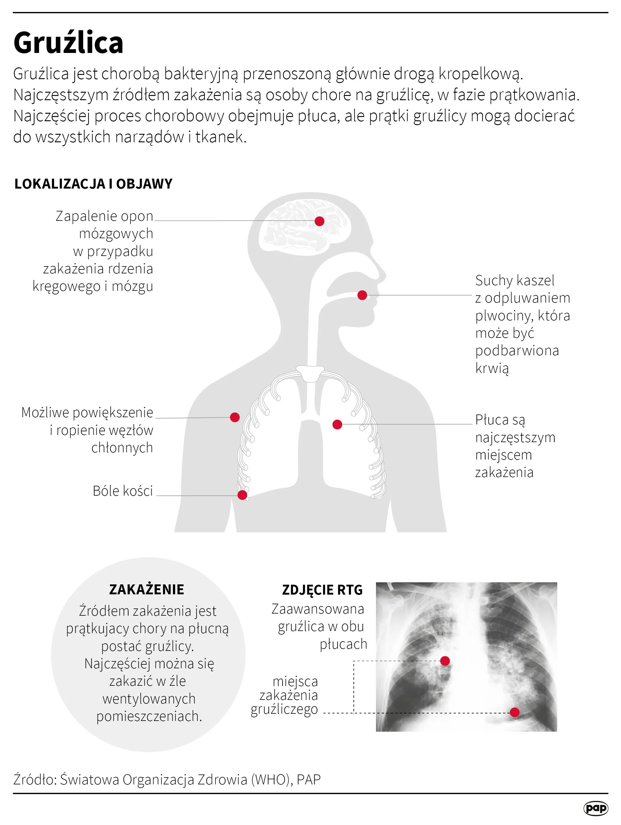 Źródło: Infografika PAP